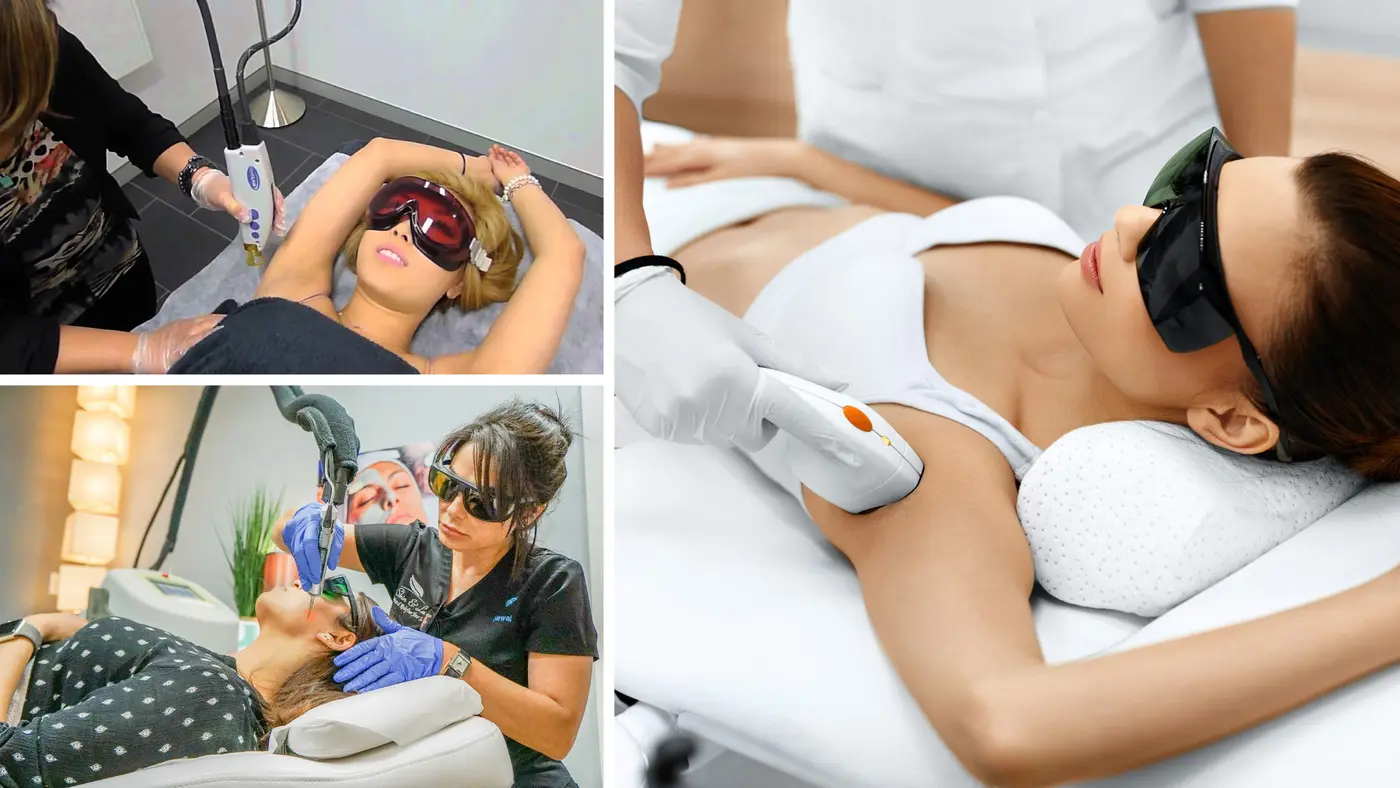 Laser hair removal